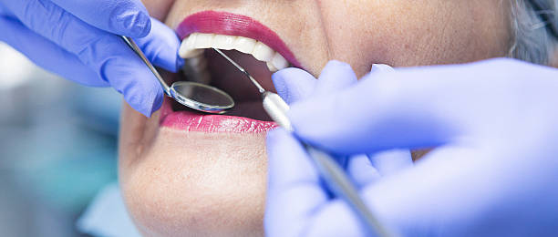 Best Emergency Treatment for Dental Infections or Abscesses in Blackwood, NJ